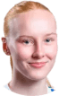 N. Kalske